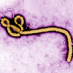 Immagine del virus Ebola, al microscopio elettronico; FONTE: CDC / Frederick Murphy