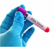 Virus ZIKA